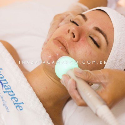 depilacao-laser-rosto